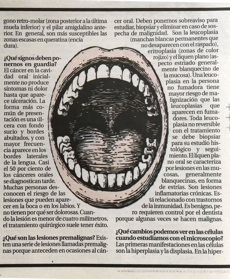 Publicación sobre cáncer oral 2