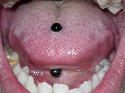 Riesgos de piercings en la boca