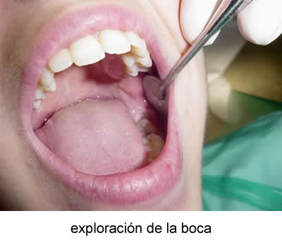 Exploración de la boca