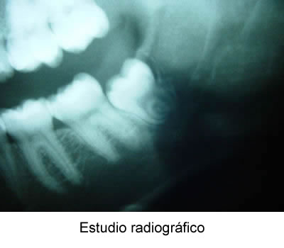 Estudio radiográfico